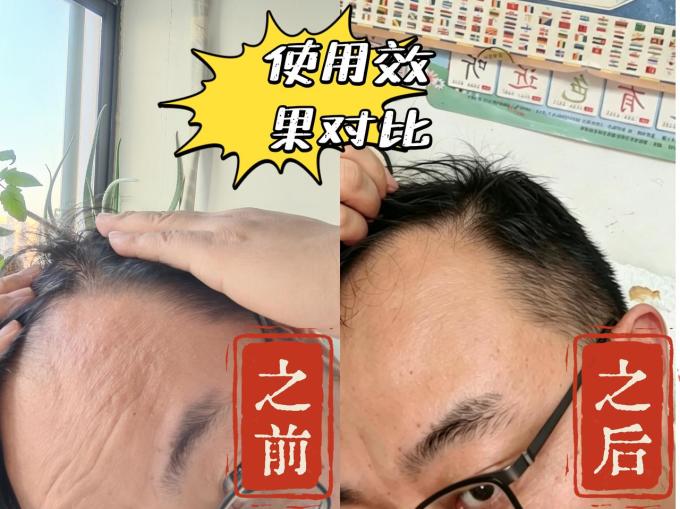 日常用药
