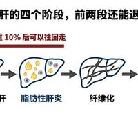 40岁查出脂肪肝,先别戒晚饭:减重10%九成肝炎消退