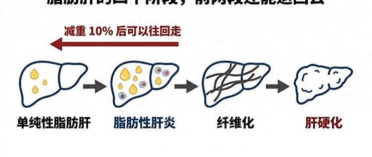40岁查出脂肪肝，先别戒晚饭：减重10%九成肝炎消退
