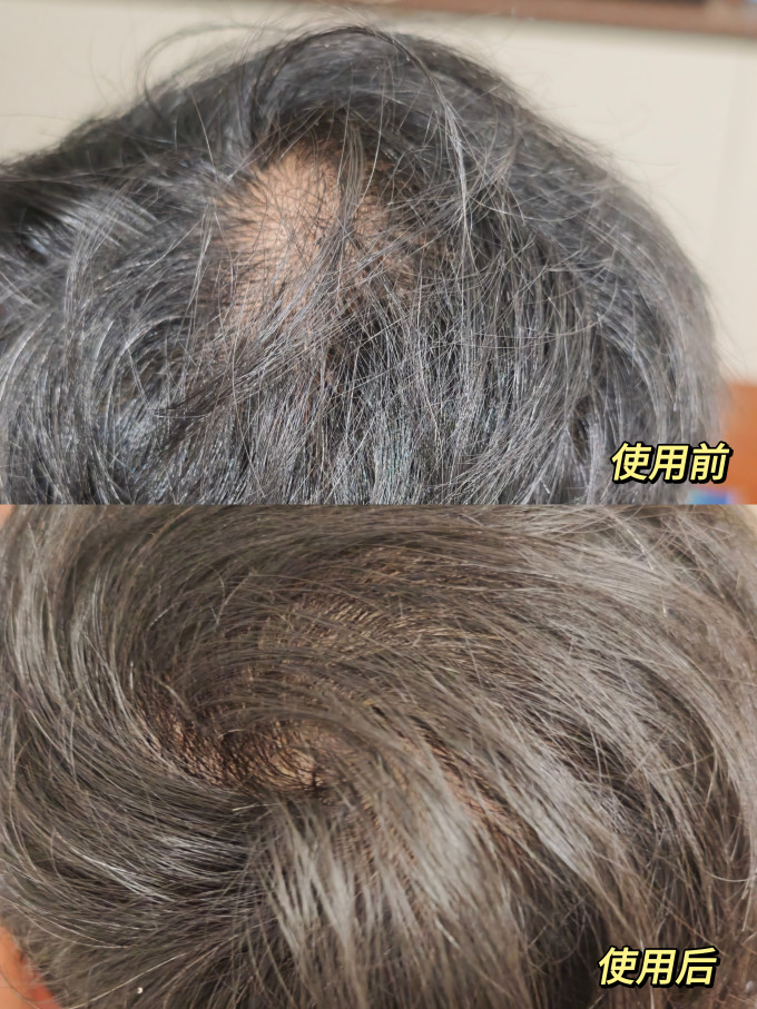 护发产品