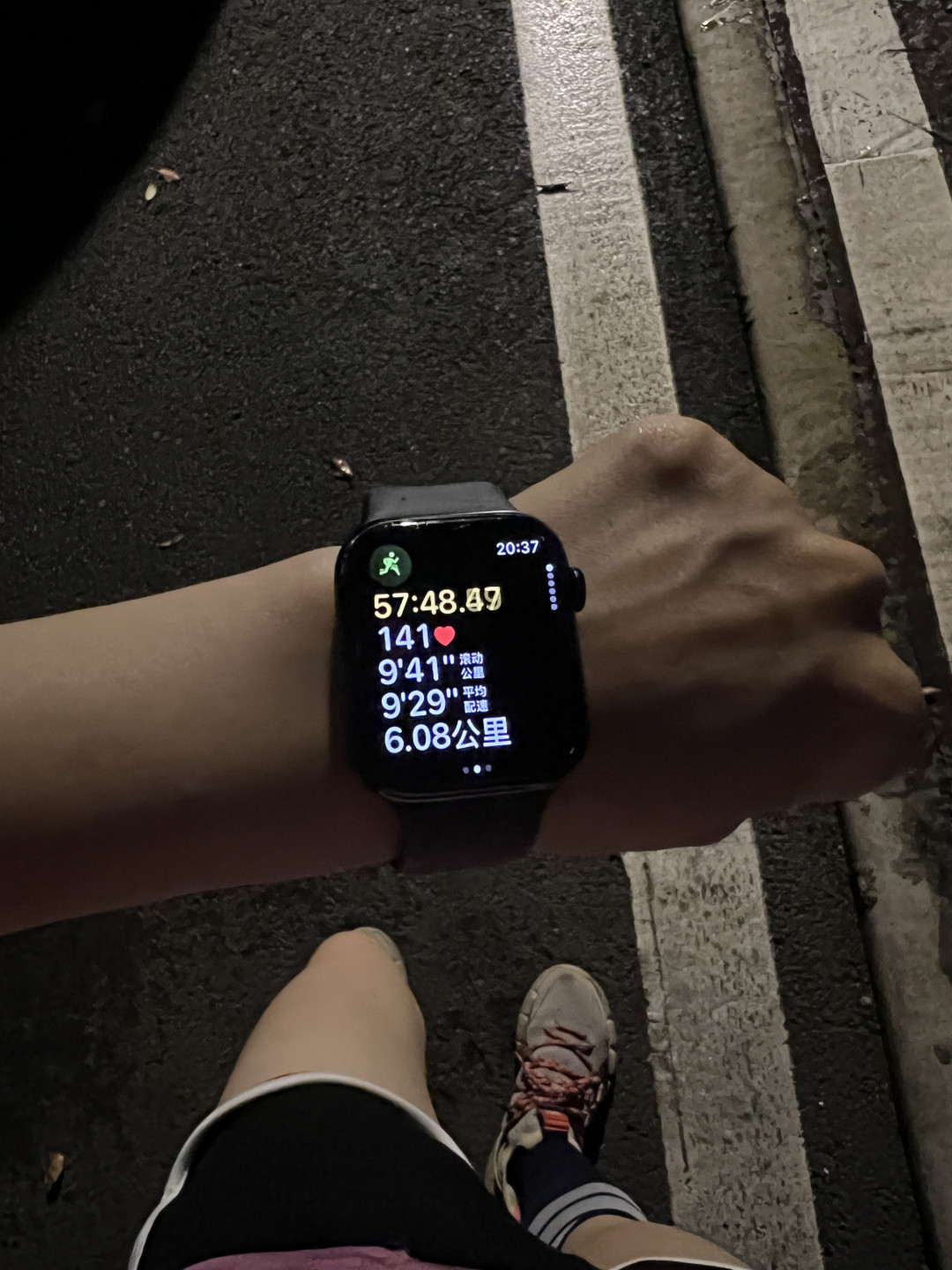 亚运冠军体脂不到10%,照样三高脂肪肝:别被瘦骗了