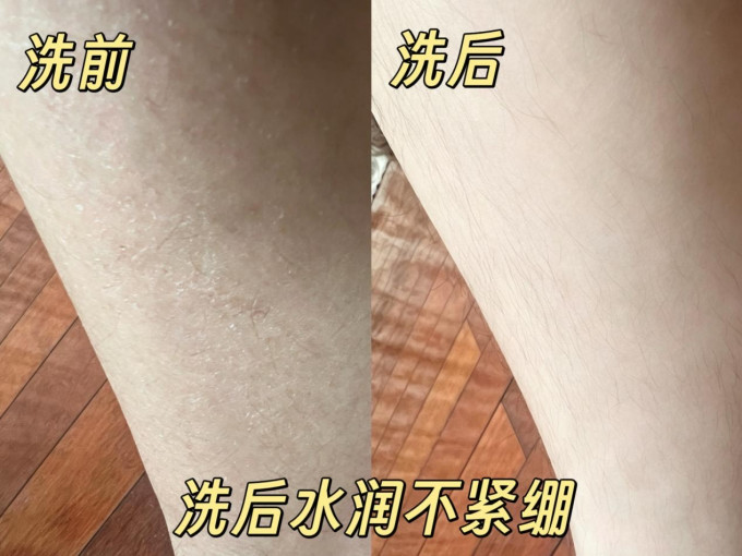 精华液