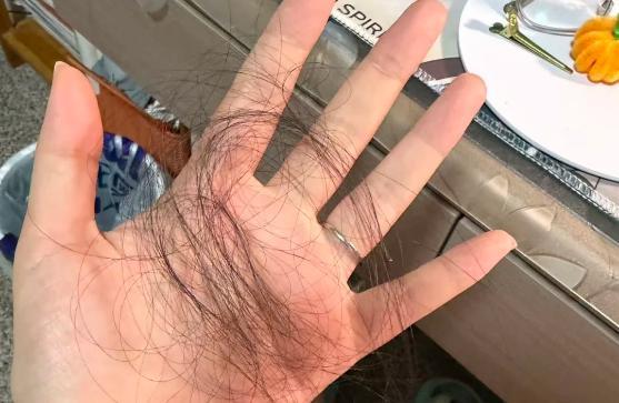 女性防脱维生素怎么选？3款真实测评分享、看看你适合哪一瓶