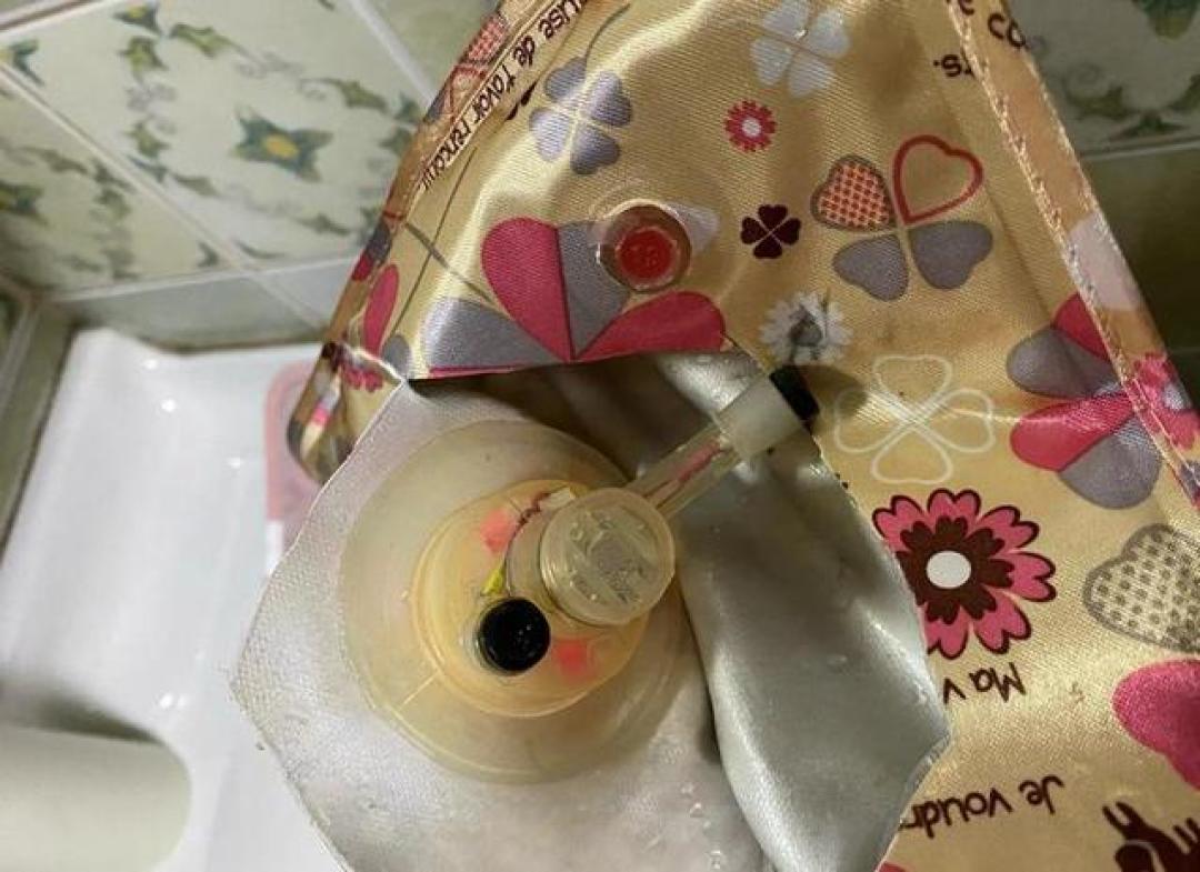 热水袋烫出植皮手术?不烫手也伤人:先捏一捏充电口,这3种情况今天就得扔
