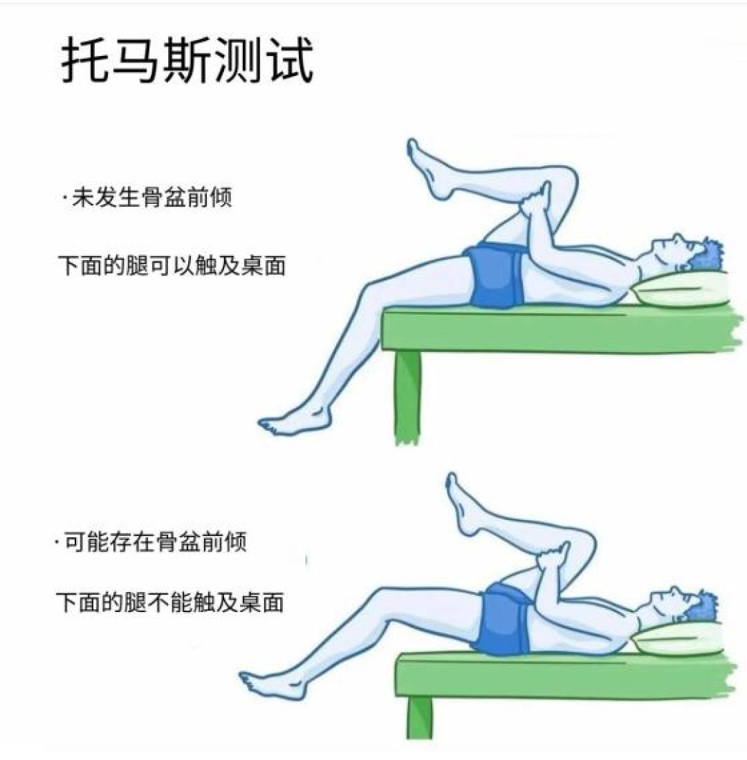 腰后塞得进一个拳头,不等于骨盆前倾:先分清筛查和诊断