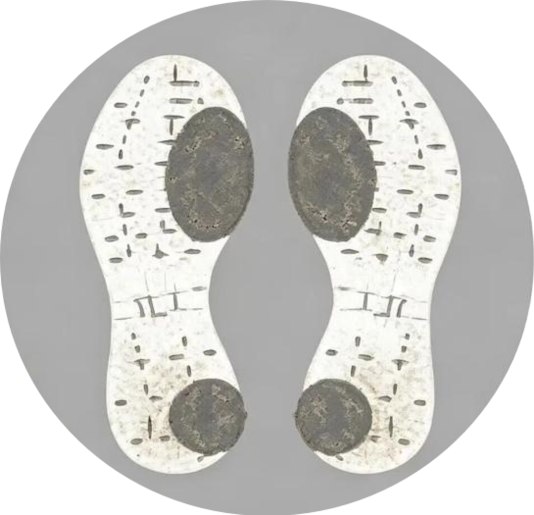内侧磨损示意
