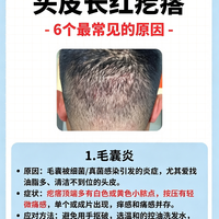 头皮反复长红疙瘩别乱抠！6个元凶对照自查，越抠越容易留疤
