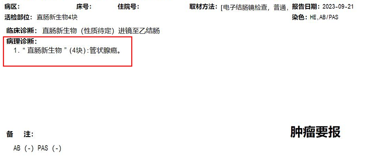 “十人九痔”是真的，但痔疮和肠癌可以同时长在同一个人身上