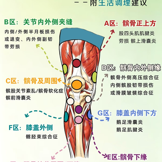 膝盖不同位置疼,分别是什么问题