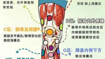 膝盖不同位置疼，分别是什么问题
