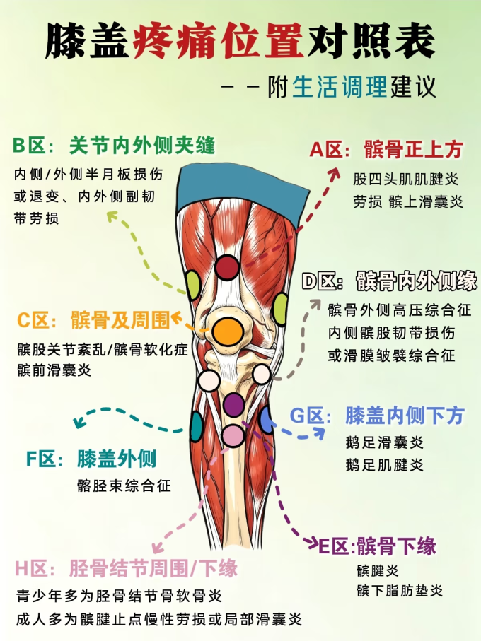 运动护具