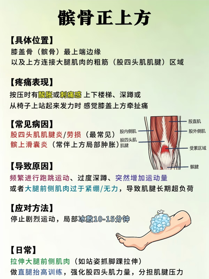 运动护具
