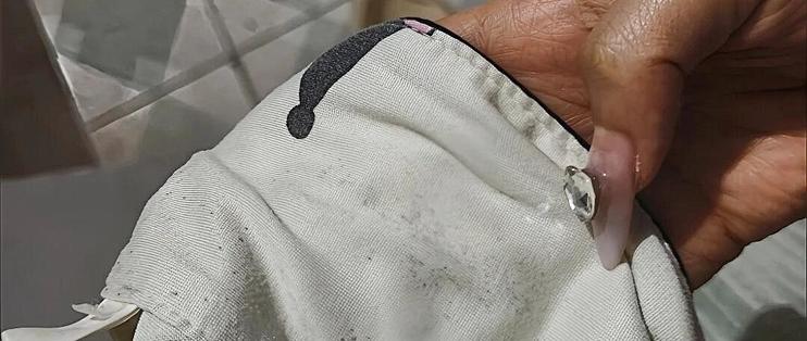 翻出的冬装长了黑霉点？越搓越大、开水锁死：先查衣和料，再决定救不救