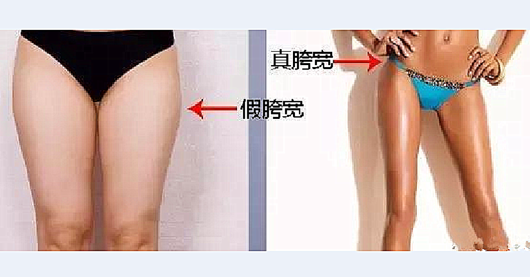假胯宽练了没变化:先分清那块凸起是脂肪、骨头,还是髋内旋