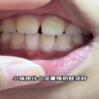 如何为低龄儿童选择无氟牙膏