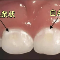 孩子不爱刷牙，牙齿都“脱矿”了！这时候还能补救吗？
