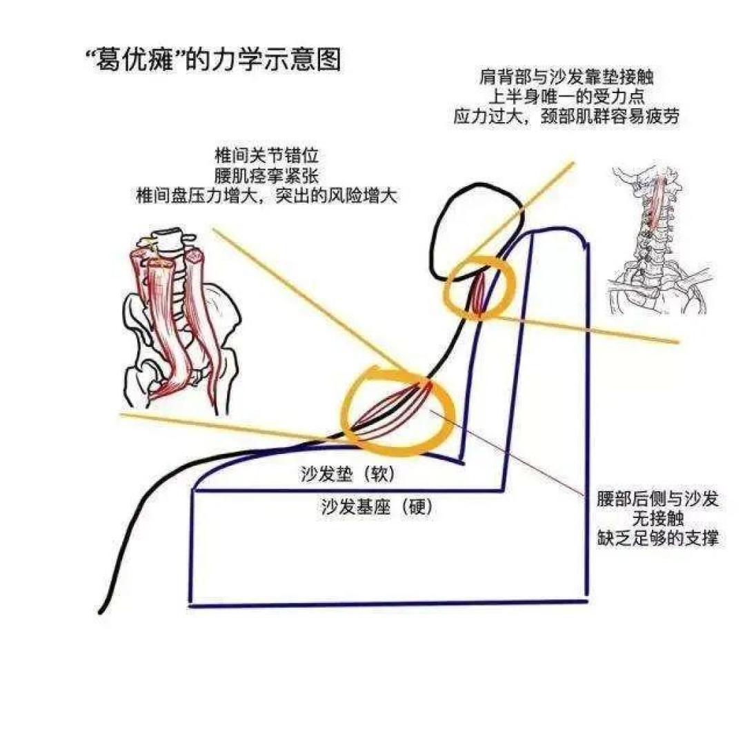 报瑜伽还是普拉提?先别急着付年卡钱,算清你能去几次