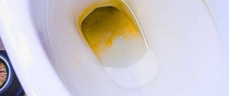 马桶内壁一圈黄垢，白醋加小苏打泡一夜，一冲就亮