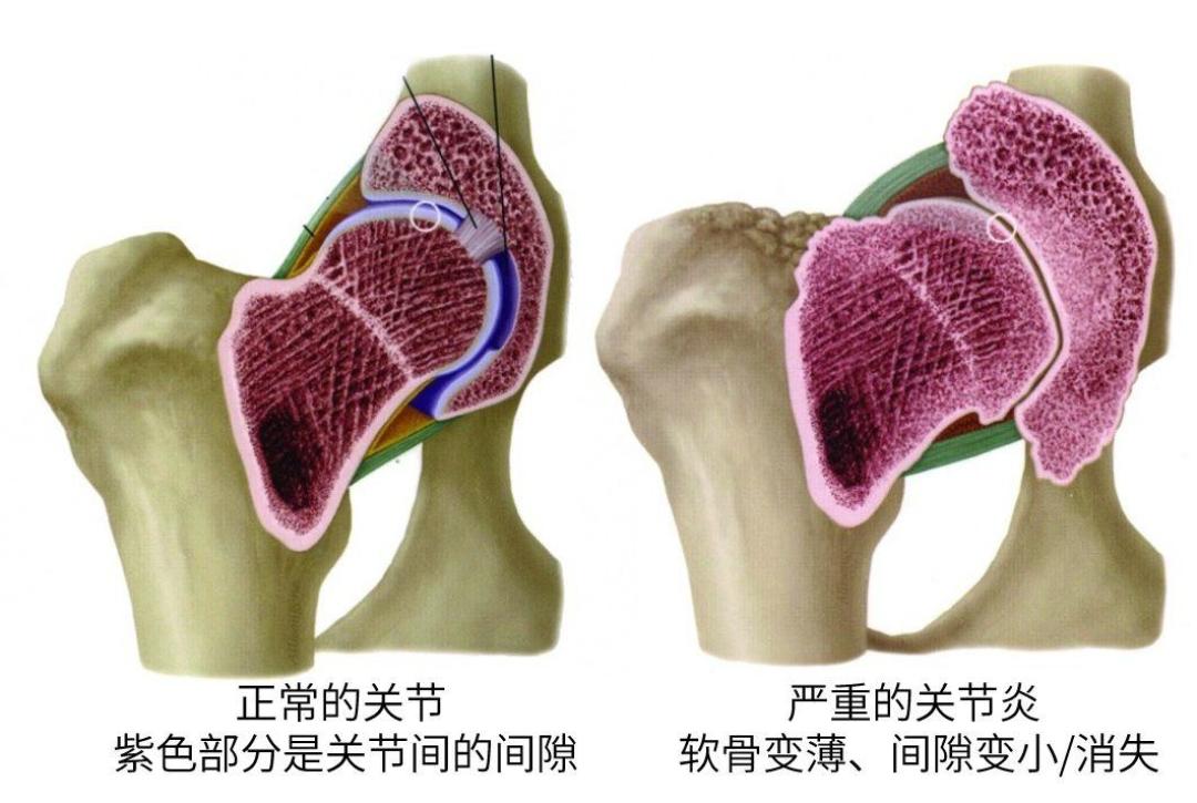 猫跳不上窗台,不是变稳重了:老猫关节疼的信号,很多人等跛行才看懂