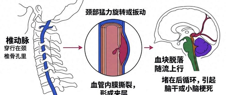 40岁兄弟脖子咔咔响多半没事，但猛扳真出过事