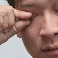 干眼为什么一直治不好？可能漏了这个关键原因